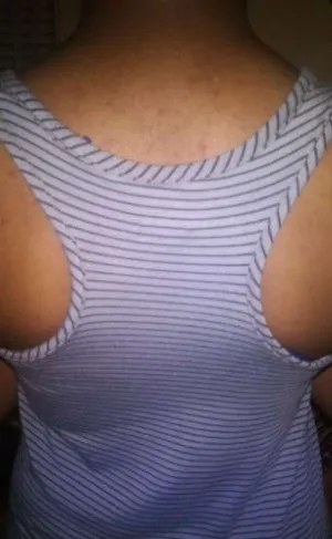 Bretelles de Soutien-Gorge (Lot de 3)