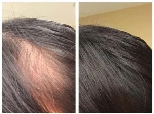 Sérum densité 100% naturel pour la croissance des cheveux