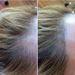 Sérum densité 100% naturel pour la croissance des cheveux