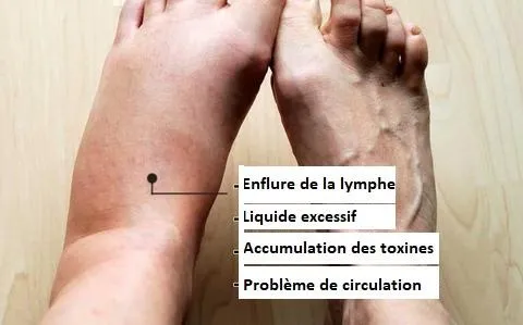 DRAINAGE LYMPHATIQUE HUILE DE GINGEMBRE