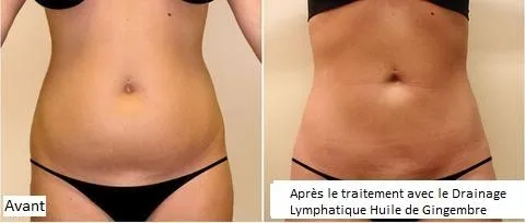 DRAINAGE LYMPHATIQUE HUILE DE GINGEMBRE