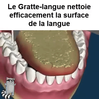 Gratte-langue