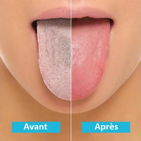 Gratte-langue