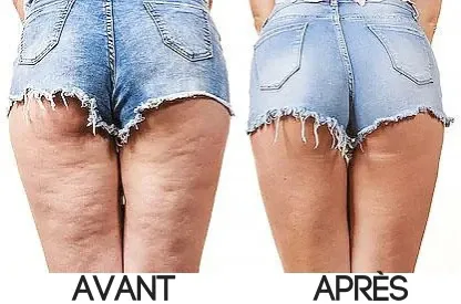 Legging Anti-cellulite Gainant