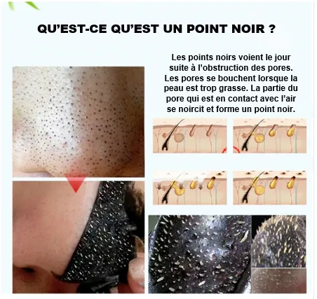 Masque Anti-Point Noir