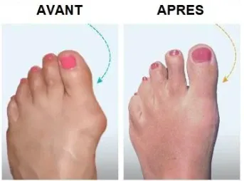 Sandales Plateformes Confortables Pour Femmes