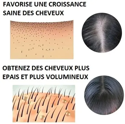 Sérum Capillaire à la Biotine Végétale