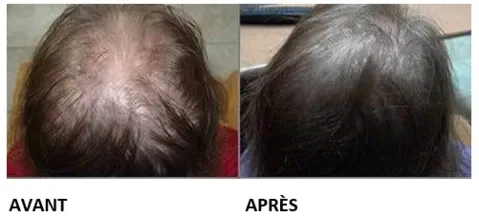 Sérum Capillaire à la Biotine Végétale Sérum Capillaire à la Biotine Végétale