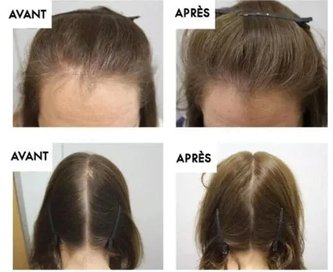 Sérum Capillaire à la Biotine Végétale Sérum Capillaire à la Biotine Végétale