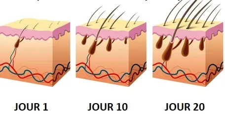 Sérum densité 100% naturel pour la croissance des cheveux