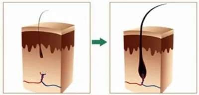 Sérum densité 100% naturel pour la croissance des cheveux