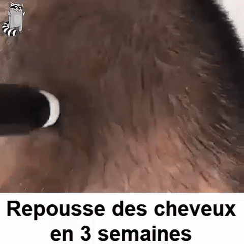 Sérum de repousse des cheveux en Roll-on Sérum de repousse des cheveux en Roll-on